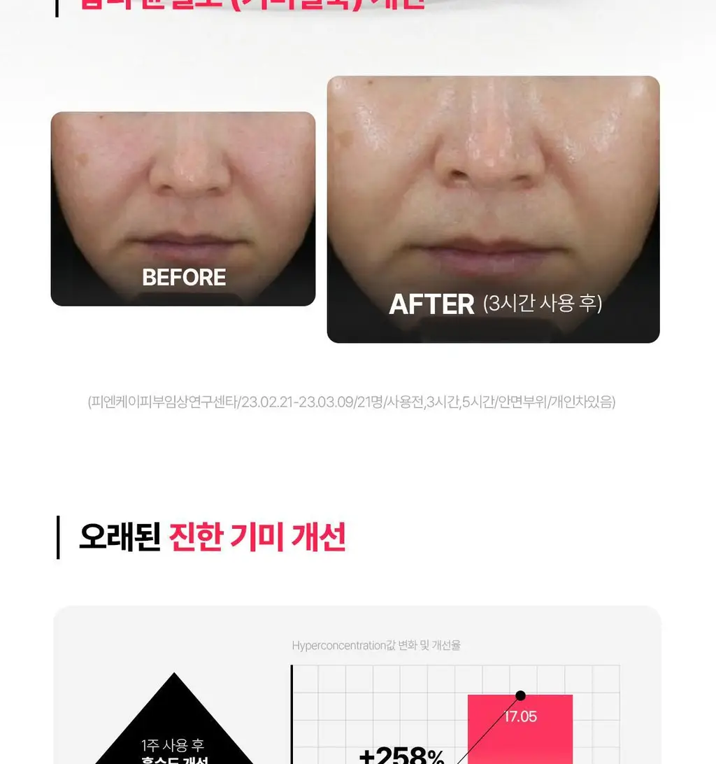[기미잡티앰플] 센텔리안24 마데카 멜라 캡처 앰플 맥스 15ml 2입 기획 상세페이지 13